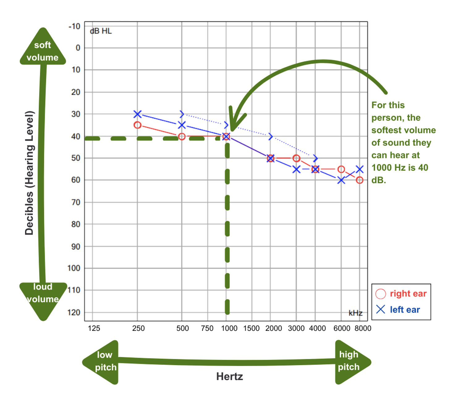 How to decipher an audiogram